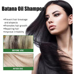 Cuida tu Cabello con el Champú Nutritivo Batana 🌿💆‍♀️