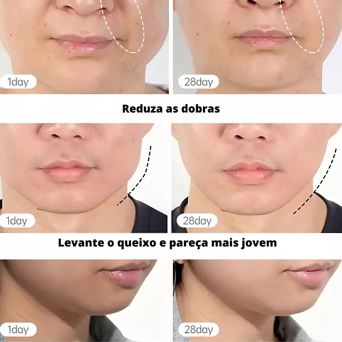 Masajeador Facial – Reafirma, Tonifica tu Rostro y Elimina papada