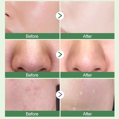 🍃 Limpia, hidrata y rejuvenece tu piel al instante con Green Mask Stick ✨