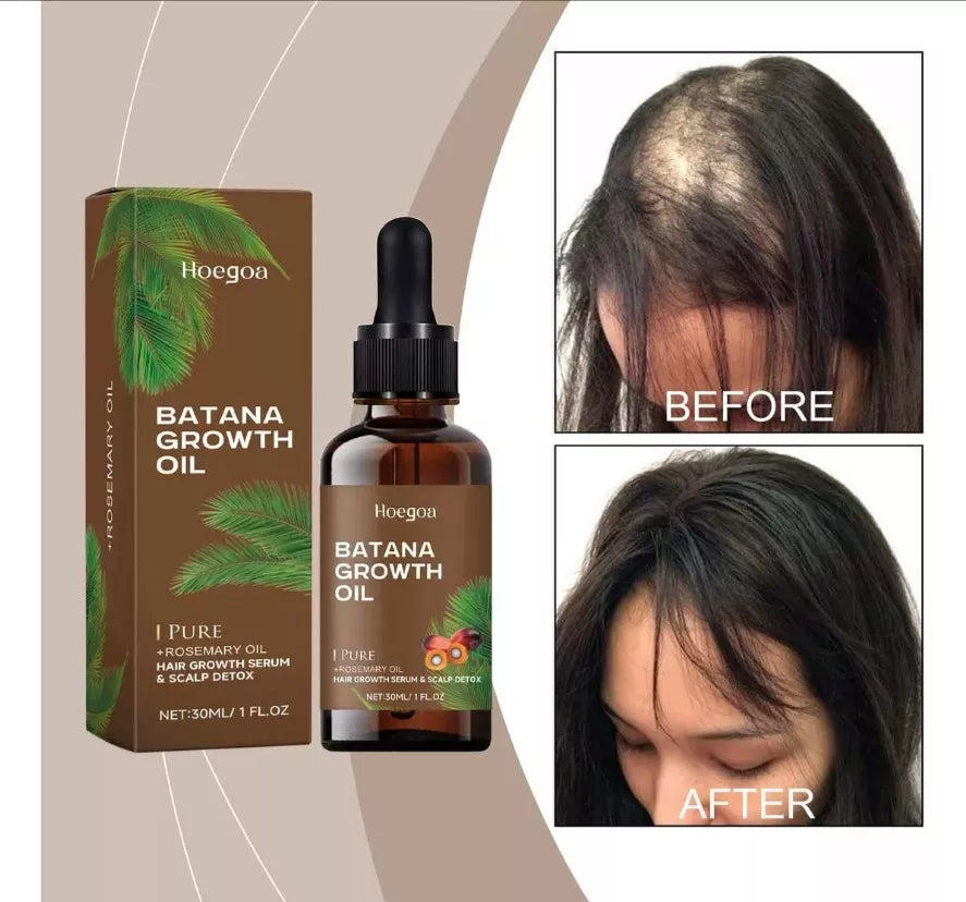 Recupera el Crecimiento y Brillo de tu Cabello con Aceite de Batana! 🌿✨